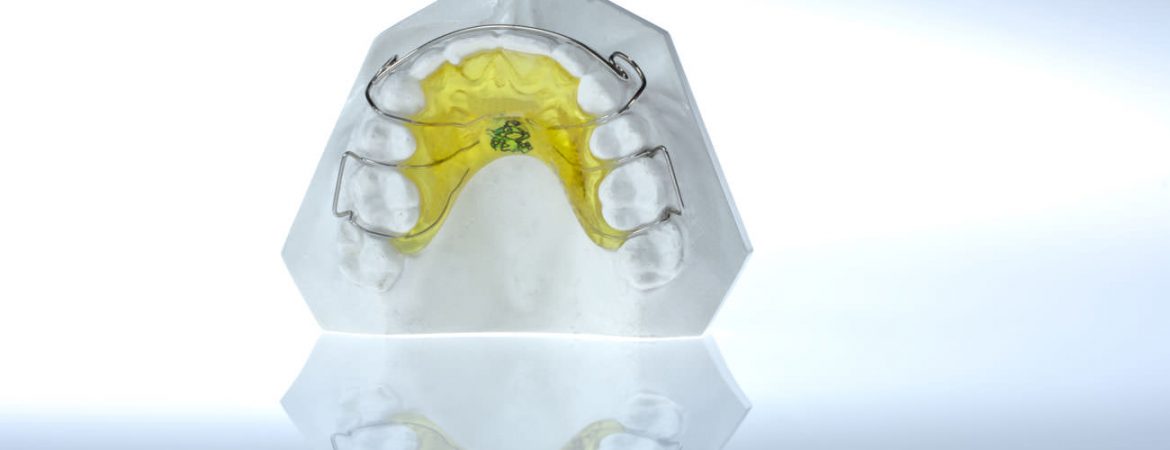 cuestiones-ortodoncia-tratamientos-clinica-dental-ignacio-espona-brackets-granada