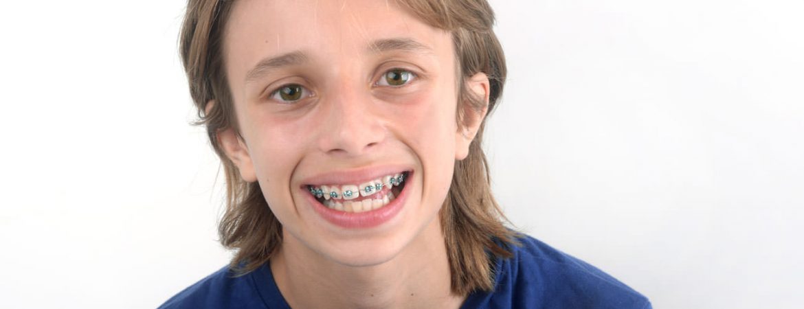 ortodoncia-infantil-tratamientos-clinica-dental-ignacio-espona-brackets-granada